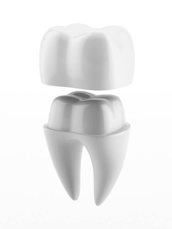 Dental crowns